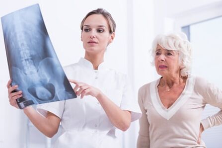 Der Arzt zeigt dem Patienten ein X -Ray -Bild der Wirbelsäule