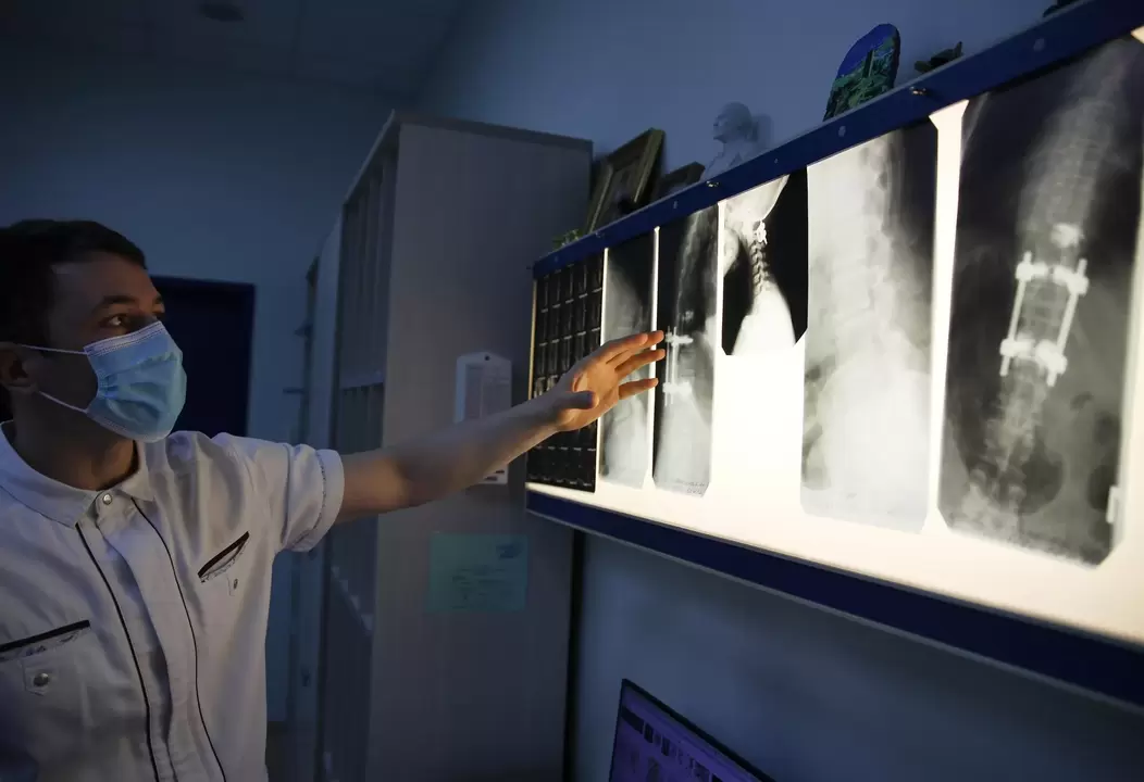Ärzte diagnostizieren eine zervikale Osteochondrose mithilfe instrumenteller Methoden wie der Radiographie